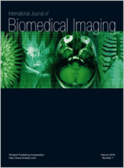 International Journal Of Biomedical Imaging雜志